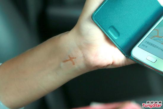 吴绮莉后悔透露女儿自残 手腕显十字印记