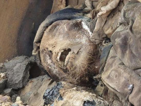 自贡挖出百年干尸牙齿清晰可见衣物都未腐坏