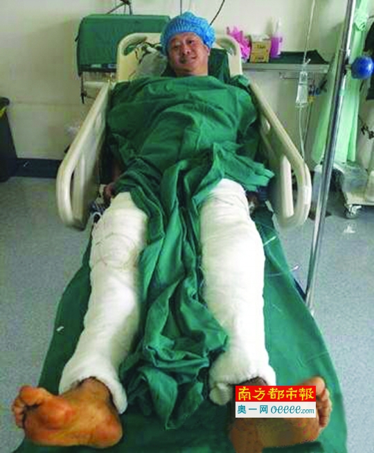 明星挨打哪家强甄子丹新戏鼻梁被劈伤