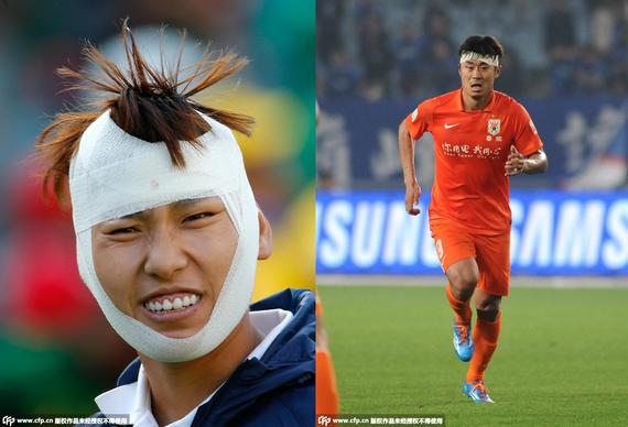 头缠绷带上阵再不是男韩鹏的专利