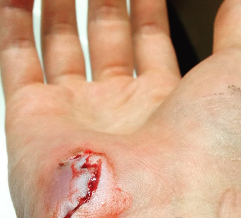 eg队员ppd右手受伤恐影响ti5备战甚至参赛