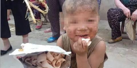与猪同住男孩获每月5百救助金