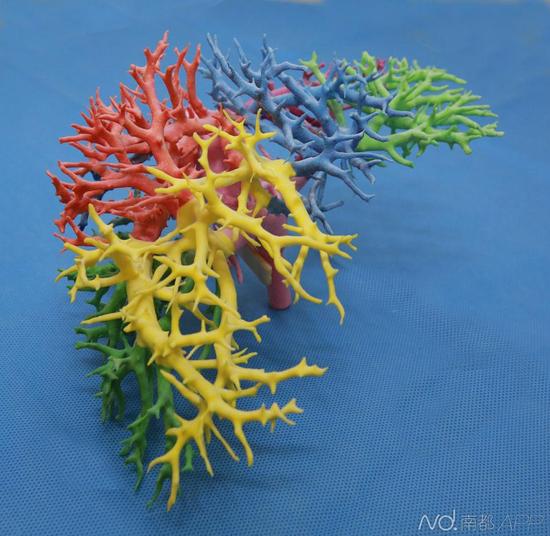 3d打印出来的骨头将在五六年内投入临床