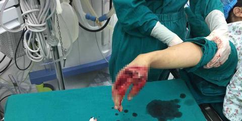 广东砍女医生者供认作案经过
