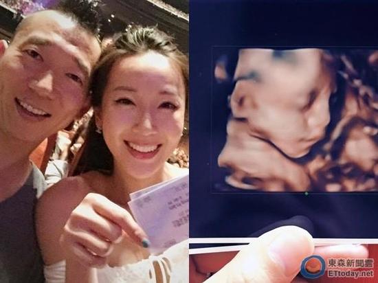 隋棠曝7月胎儿b超照宝宝鼻梁超挺像妈妈