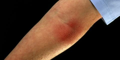 警惕.吃一种菜后暴晒小心毁容