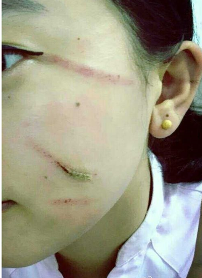 高铁女乘务员被一家12口围殴 脸被抓花(图)