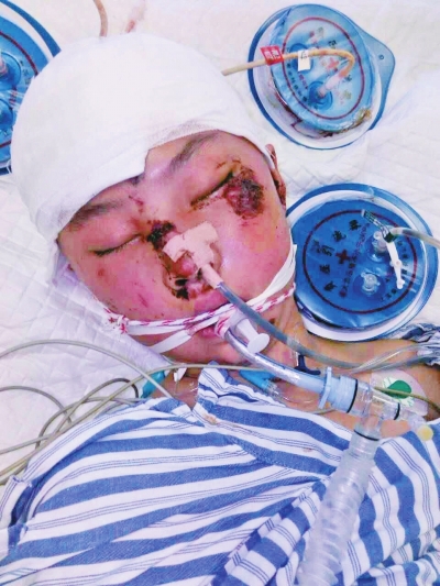 固始高二女生突发车祸昏迷50天