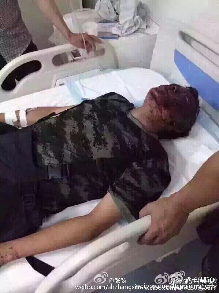 因爆炸伤亡的消防官兵