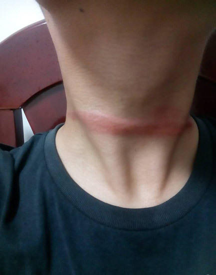 义乌1骑车小伙夜行被勒脖.图