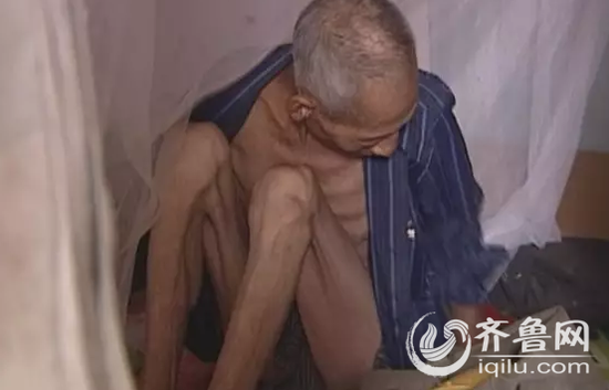 无名老人被弃出租屋 瘦骨嶙峋生活不能自理(图)