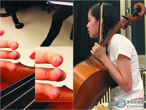 风光的背后，是长时间练琴，手指练到皮开肉绽换来的。