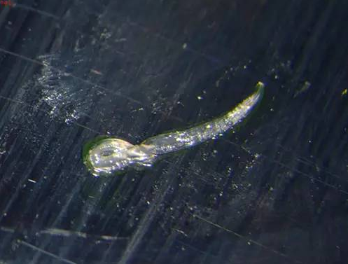 杭州大姐眼睛里爬出两条活虫 或来自家里的狗(图)