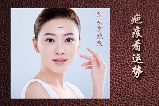 一,额头有疤痕人之面相与命运有必然的联系,面相学中我们经常谈及五官