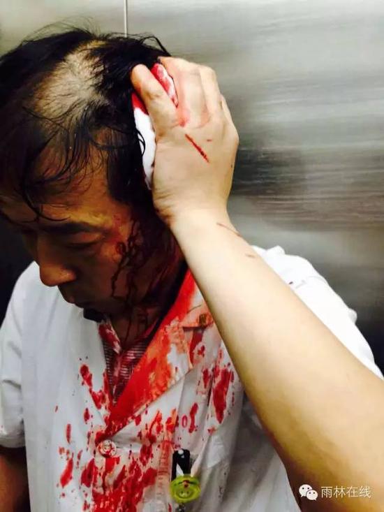 江苏男子酒后暴力袭医 被打医生头破血流(图)