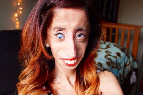 她是"全世界最丑女人"