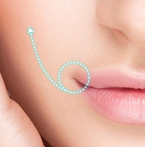 五,微笑唇形超声刀是利用聚焦超声刀高强度超声波治疗装备,将超声波热