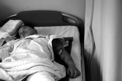 受伤女子等待手术