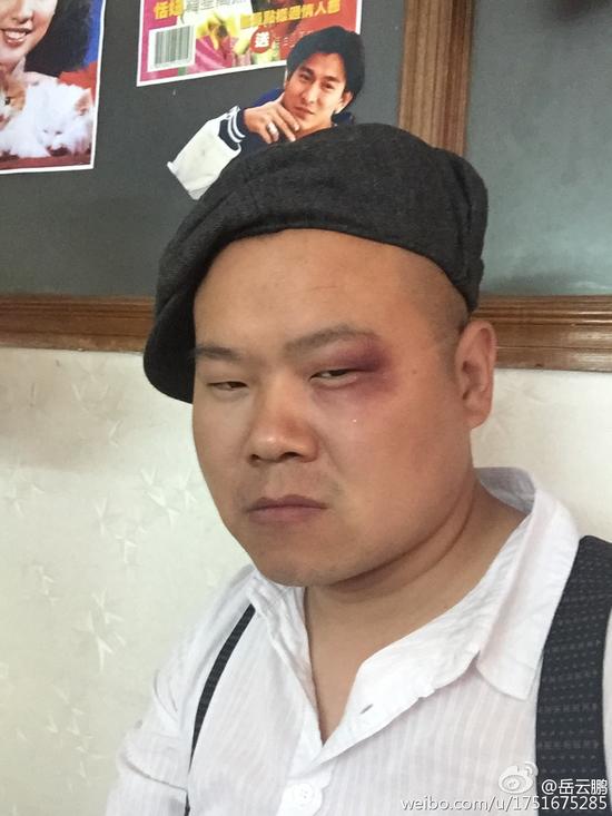 岳云鹏搞怪自拍