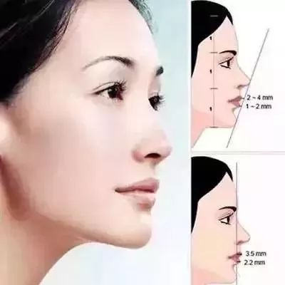 下巴,颈部之间的联系决定了面部的美学比例,鼻子下巴形成完美直线