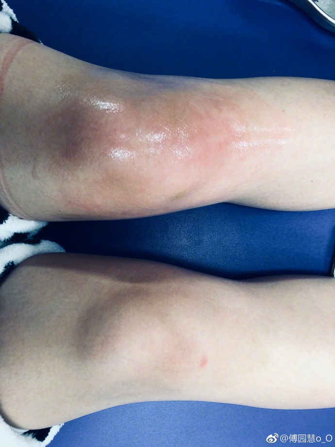 从想退役到拿下亚运银牌,傅园慧的洪荒之力还