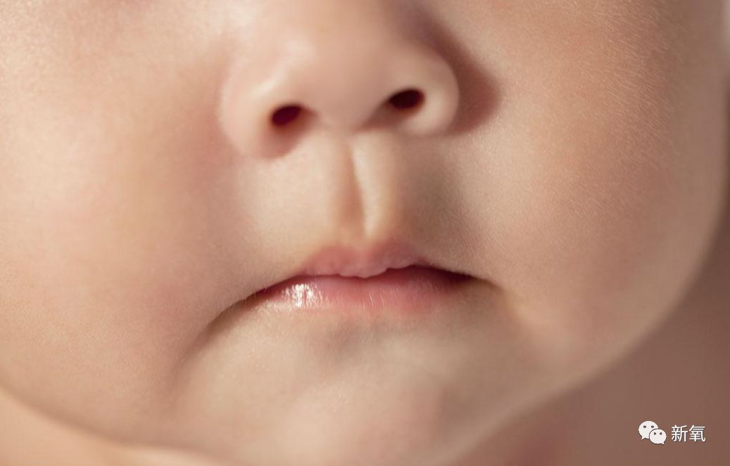 曾经整成张柏芝爆红的女明星如今拆掉鼻子假体竟然变成阿娇