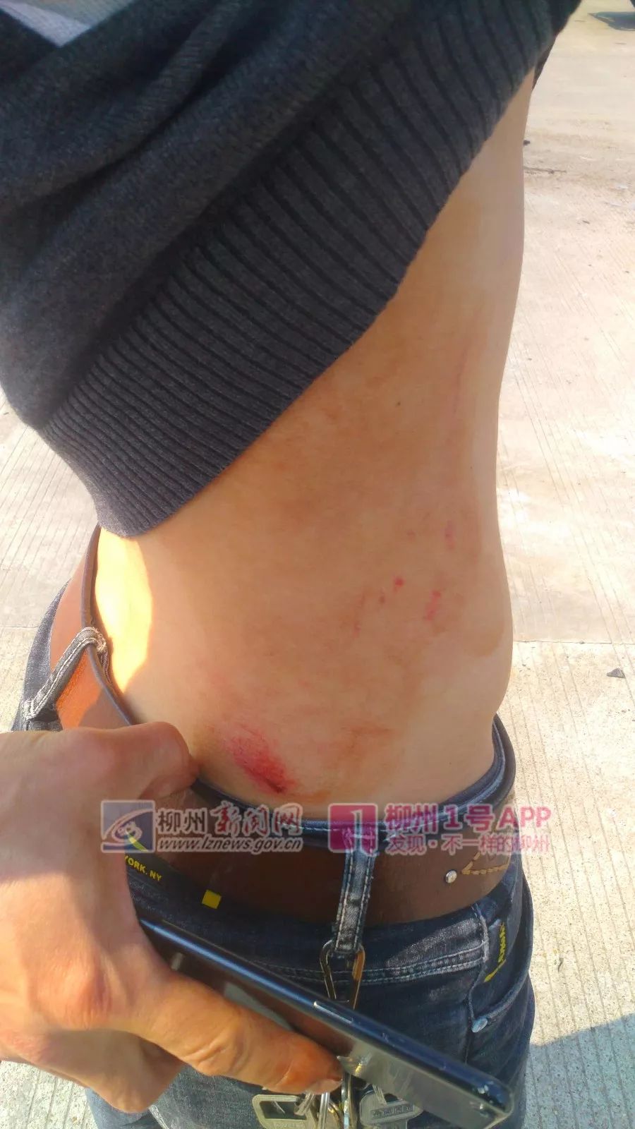 五菱神车被轿车撞翻司机受伤轿车安全气囊弹开车头受损