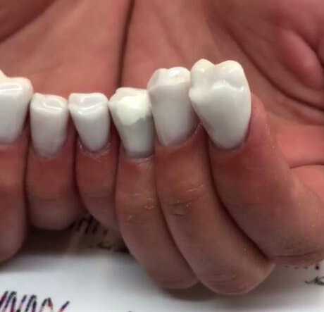 牙齿形状的美甲太逼真引网友热议强迫症者直呼受不了