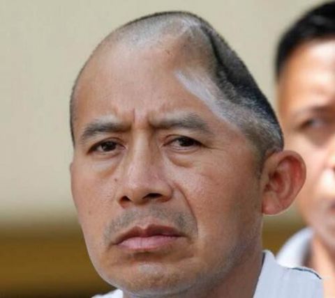 大叔脑袋被打没一半,却意外获得了5800万美金,你觉得值么?