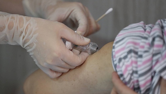 靶向生物制剂dupixent内地首针注射完成可治疗特应性皮炎