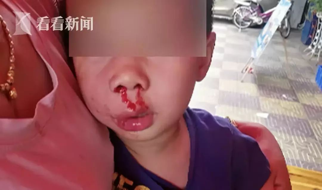 4岁男童撞到点餐男子竟被踹飞颅内出血当场昏迷