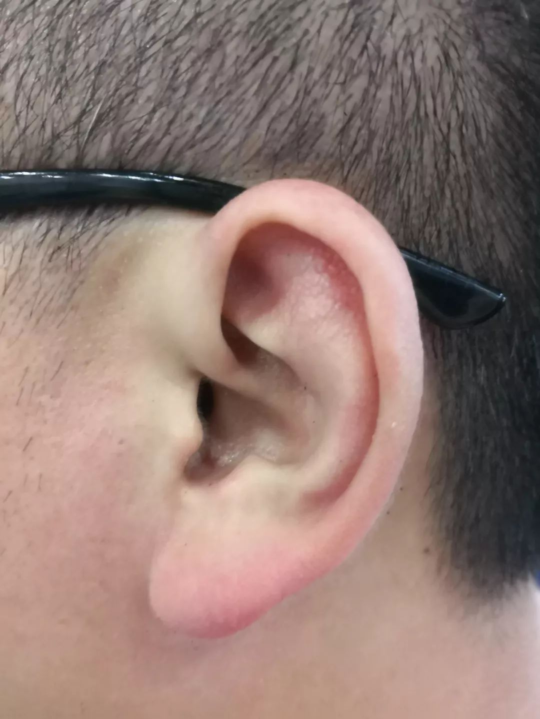 啪哈尔滨一男子半夜一巴掌把蚊子拍进了耳朵里网友的回复绝了