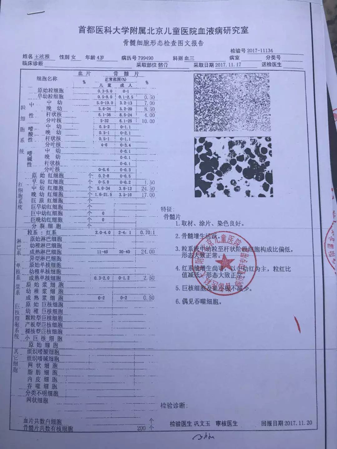 不能确定原发病,现在专家研究建议唯一可以救我的治疗方案是骨髓移植