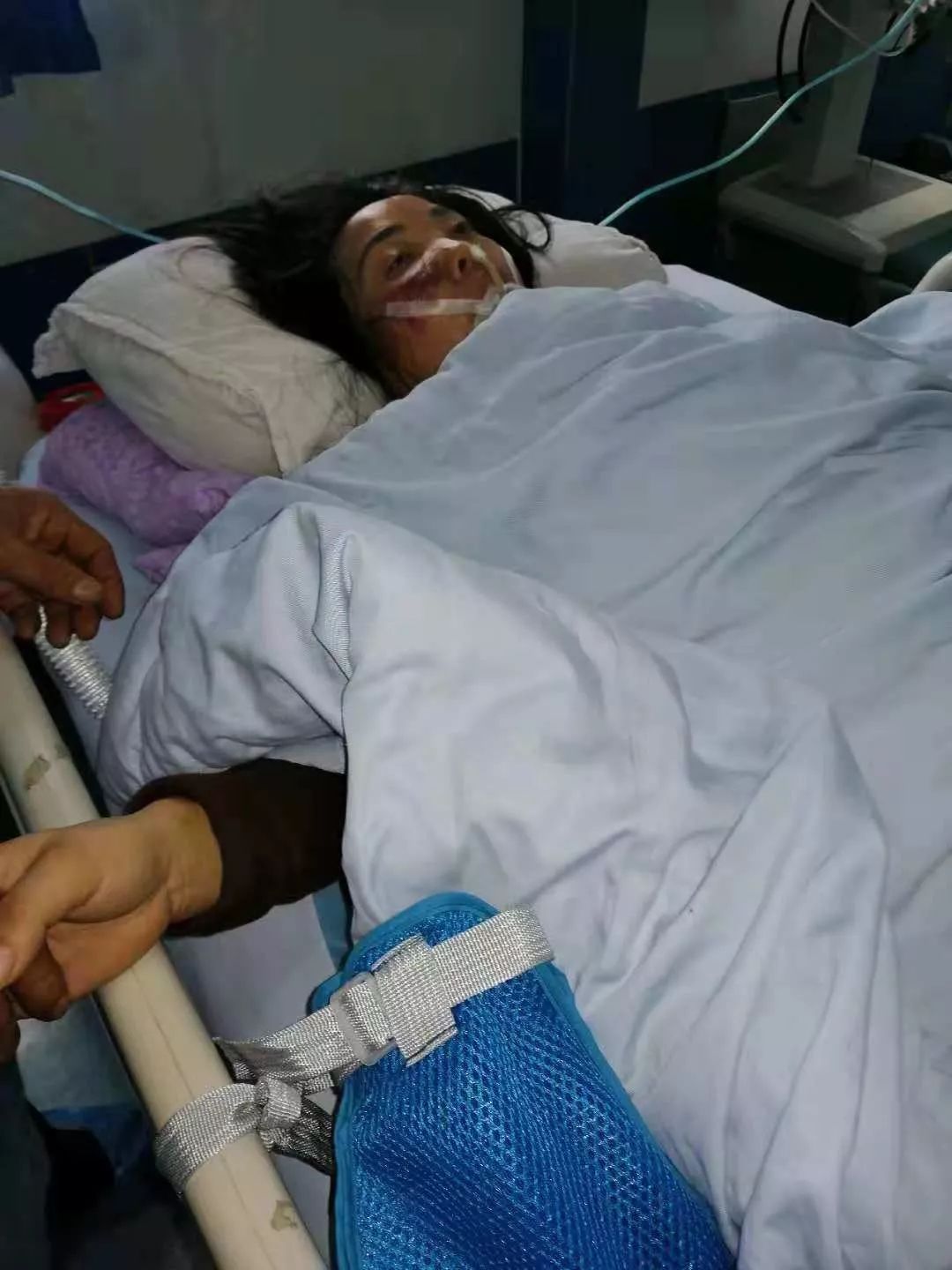 凯里一女子在人行道上被轿车撞伤,而肇事司机却