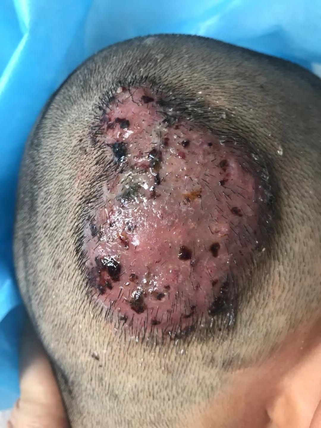 5岁男童不但头上长出犄角还破溃流脓罪魁祸首竟是家里的这个动物