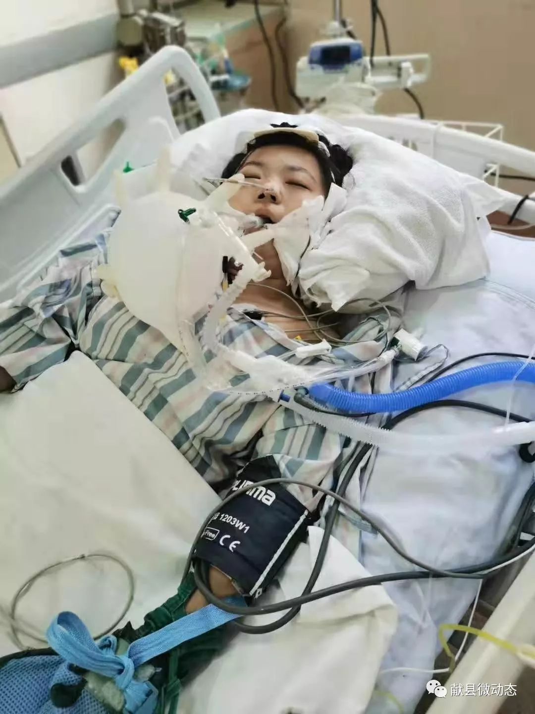 全城关注沧州女孩刘格格伤情突然恶化一起为她祈祷