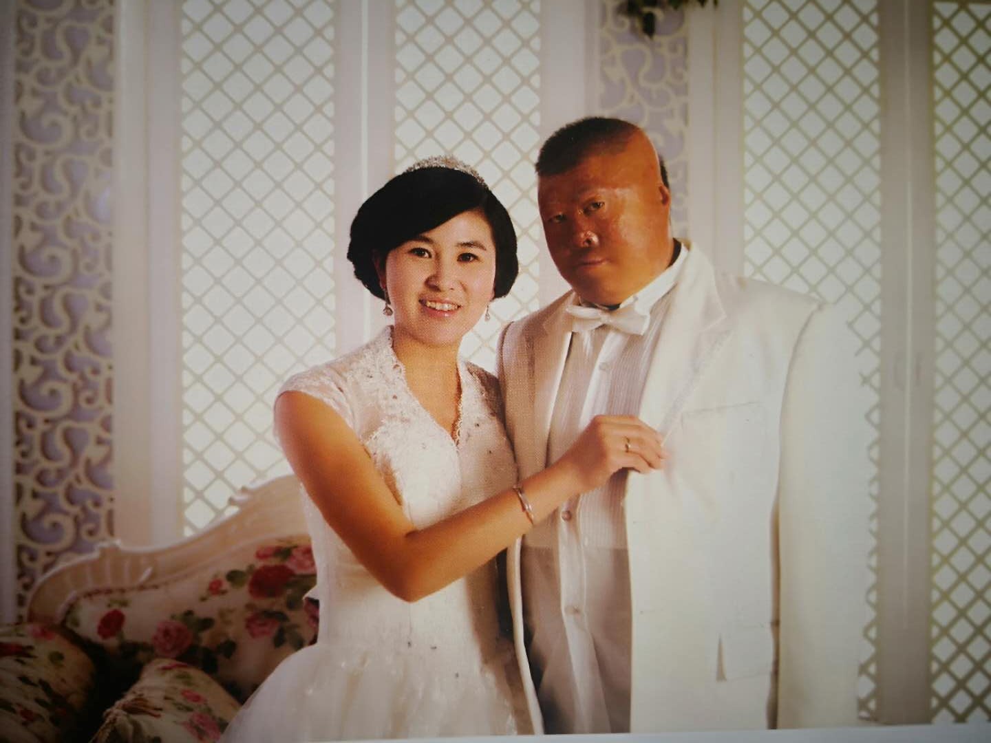 男子见义勇为被毁容获老人救助与妻办养老院回报 手机新浪网