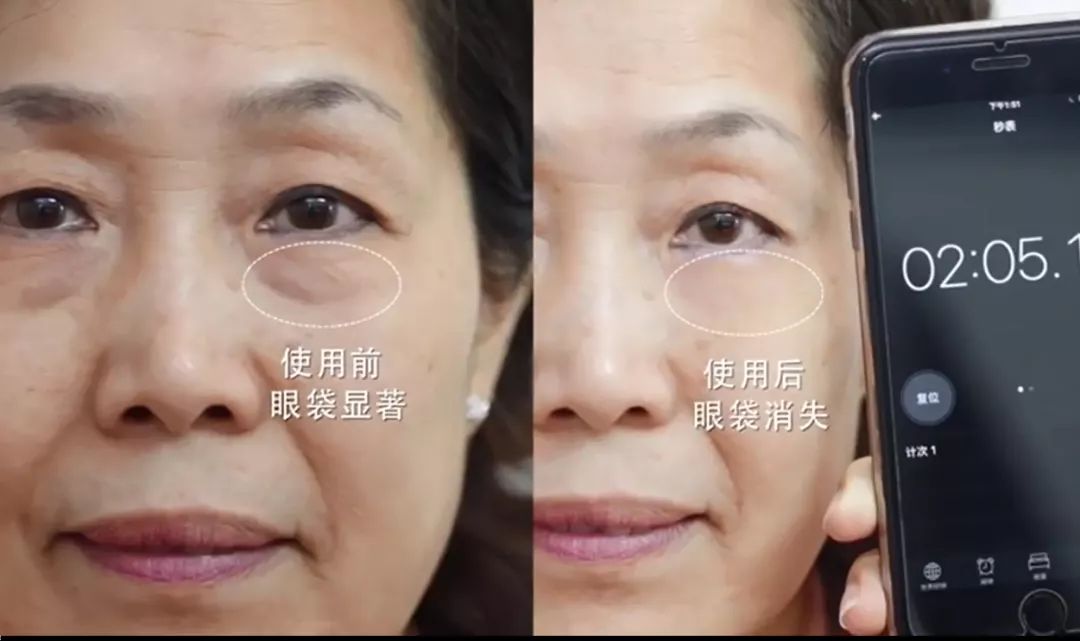 不用开刀,用它抹一抹,120秒去眼袋,年轻10岁!