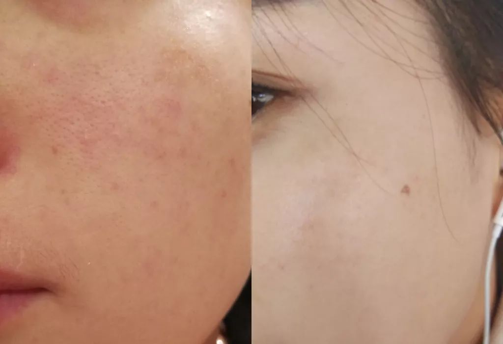 3天瘦2斤,吃着吃着就瘦了,这是怎么做到的?