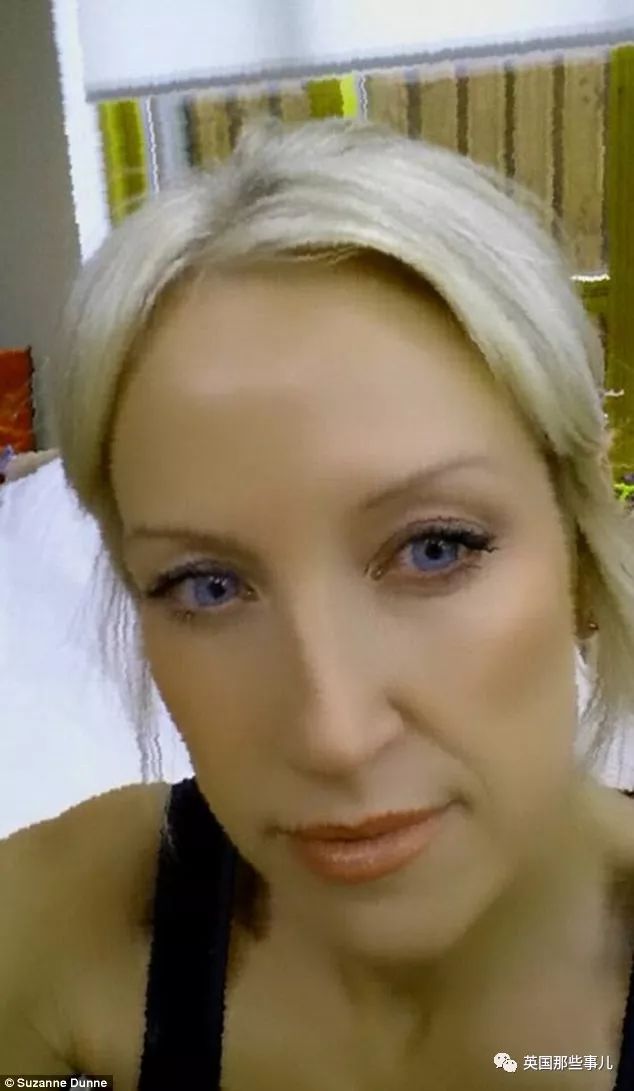 来自都柏林的护士suzanne dunne平时也喜欢佩戴隐形眼镜