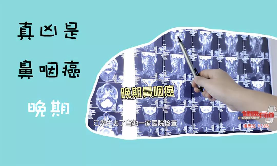 别怕,专家教你怎么防治它|鼻咽癌|放疗|化疗_新浪新闻