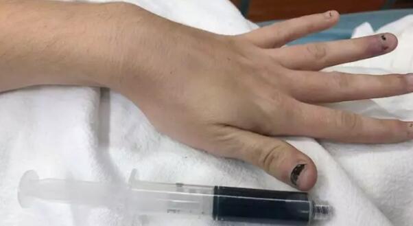 蓝色的血液看上去有点吓人她的血都已经是蓝色的了!