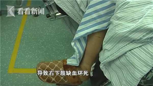 一场感冒让24岁女孩右腿截肢差点连命都没了