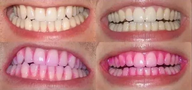 育儿| 为了娃的高颜值和口齿清晰!这件事请一直帮ta做到7岁!