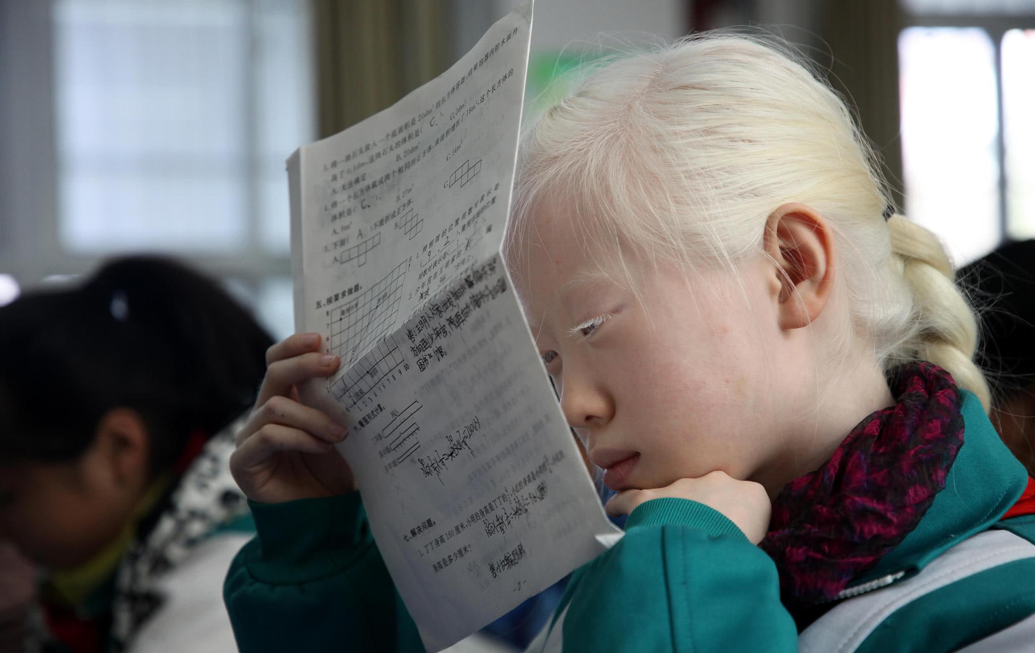 11岁白化病女孩视力仅004同学争当她的眼睛