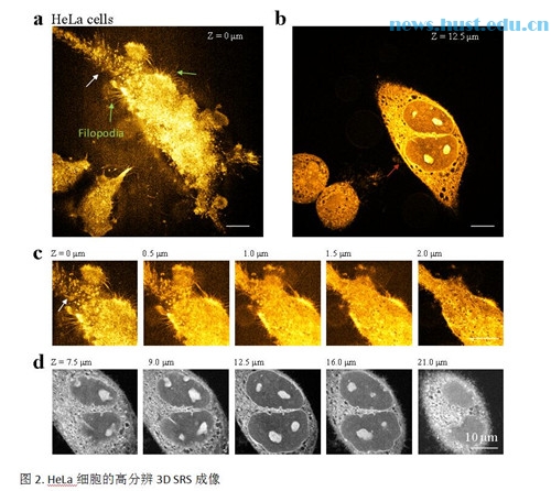 王平教授最新研究成果實現生物分子的非標記高分辨率成像