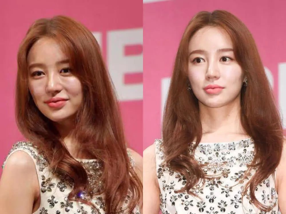 被封杀五年的尹恩惠脸崩了彻底变成老女人了