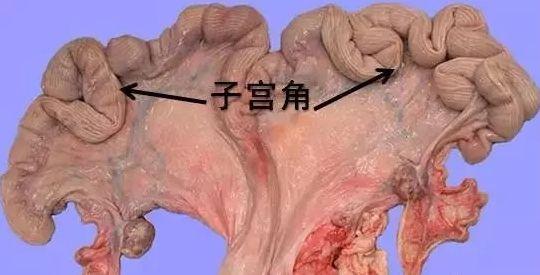 得了子宫炎的母猪断奶后发情期错后或者不发情,受精卵着床成功率低,返