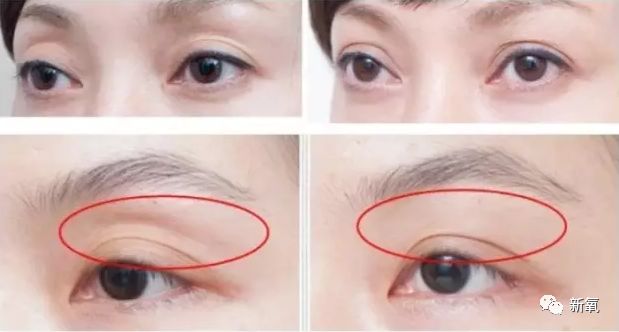 瘦了14斤的林允变成自行车座脸22岁眼皮凹成32岁