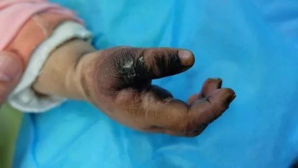 3岁女孩在家中触电身亡,导致悲剧的竟是